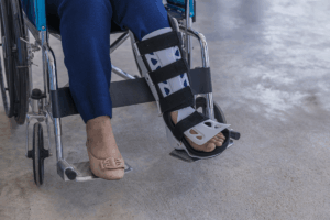 Orthèse de cheville comment la choisir selon sa blessure